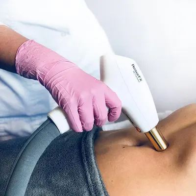 BodyMed Group Bydgoszcz - depilacja laserowa